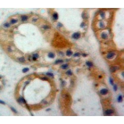 Cholinergic Receptor, Nicotinic, Beta 2 (CHRNb2) Antibody