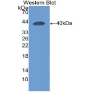 Western blot analysis of the recombinant protein.