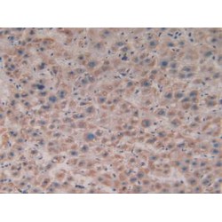 Citrate Synthase (CS) Antibody