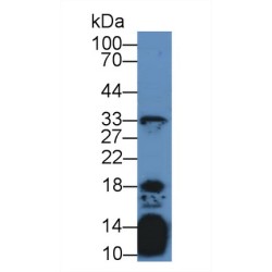 Interleukin 21 (IL21) Antibody