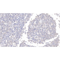 Interleukin 21 (IL21) Antibody