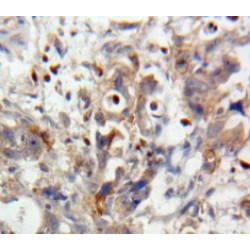 Interleukin 28A (IL28A) Antibody