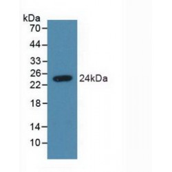 Syndecan 4 (SDC4) Antibody