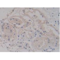 Syndecan 1 (SDC1) Antibody