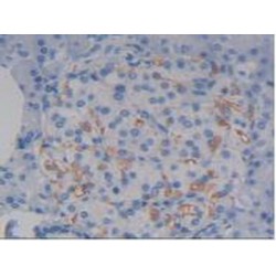 Syndecan 1 (SDC1) Antibody