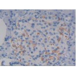 Syndecan 1 (SDC1) Antibody