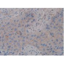 Syndecan 1 (SDC1) Antibody