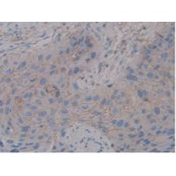 Syndecan 1 (SDC1) Antibody