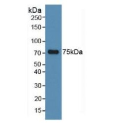 Microtubule-Associated Protein Tau (MAPT) Antibody