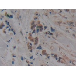 Microtubule-Associated Protein Tau (MAPT) Antibody