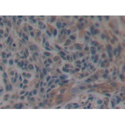 Microtubule-Associated Protein Tau (MAPT) Antibody