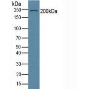 Western blot analysis of Human Serum.