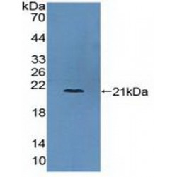 Collagen Type VI Alpha 3 (COL6A3) Antibody