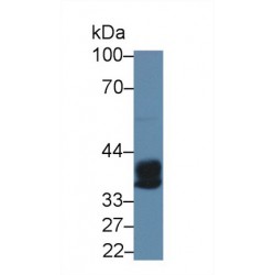 Carboxypeptidase A3, Mast Cell (CPA3) Antibody