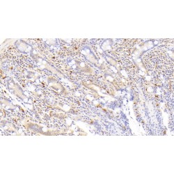 Carboxypeptidase A3, Mast Cell (CPA3) Antibody