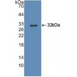 Cytochrome P450 27B1 (CYP27B1) Antibody
