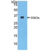 Western blot analysis of recombinant Human ABCA3.