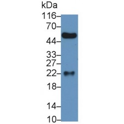Peptidoglycan Recognition Protein 1 (PGLYRP1) Antibody