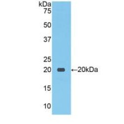Solute Carrier Family 12 Member 3 (SLC12A3) Antibody