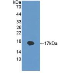 Lithostathine-1-Beta (REG1B) Antibody