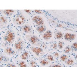 Lithostathine-1-Beta (REG1B) Antibody