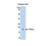 Western blot analysis of the recombinant protein.