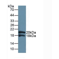 Interleukin 1 Receptor Accessory Protein (IL1RAP) Antibody