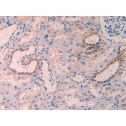 Interleukin 1 Receptor Accessory Protein (IL1RAP) Antibody