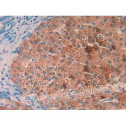 Interleukin 1 Receptor Accessory Protein (IL1RAP) Antibody