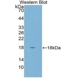Cystatin 5 (CST5) Antibody