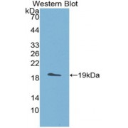Western blot analysis of recombinant Human ADAMTS5.