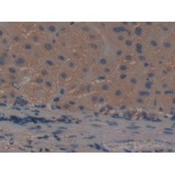 A Disintegrin And Metalloproteinase With Thrombospondin 5 (ADAMTS5) Antibody