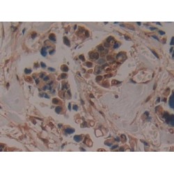 A Disintegrin And Metalloproteinase With Thrombospondin 5 (ADAMTS5) Antibody