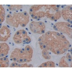 Fibronectin Type III Domain Containing Protein 5 (FNDC5) Antibody