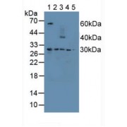Western blot analysis of (1) Human Liver Tissue, (2) Mouse Spleen Tissue, (3) Mouse Heart Tissue, (4) Human A549 Cells and (5) Mouse Placenta Tissue.