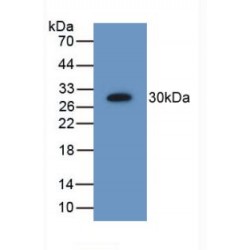 26S Proteasome Non-ATPase Regulatory Subunit 9 (PSMD9) Antibody