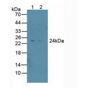 Western blot analysis of (1) Human A549 Cells and (2) Human HepG2 Cells.