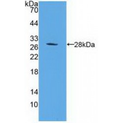26S Proteasome Non-ATPase Regulatory Subunit 10 (PSMD10) Antibody