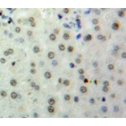 Histone Cluster 2, H2be (HIST2H2BE) Antibody