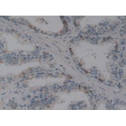 Angiotensin I Converting Enzyme (ACE) Antibody