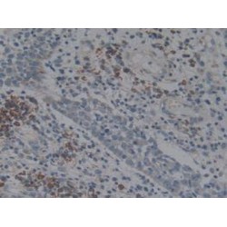 Angiotensin I Converting Enzyme (ACE) Antibody