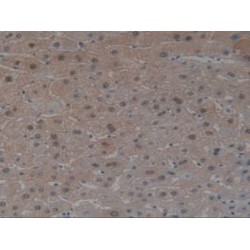 Angiotensin I Converting Enzyme (ACE) Antibody