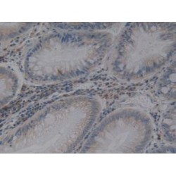 Angiotensin I Converting Enzyme (ACE) Antibody