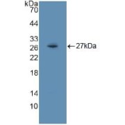 Western blot analysis of recombinant Human Flt3.