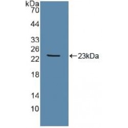Angiopoietin-1 Receptor / TIE2 (TEK) Antibody