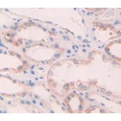 Angiopoietin-1 Receptor / TIE2 (TEK) Antibody