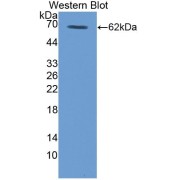 Western blot analysis of recombinant Human TPO.