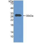Western blot analysis of recombinant Human TLN1.