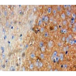 Talin-1 (TLN1) Antibody