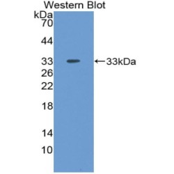 Neuronal Pentraxin II (NPTX2) Antibody